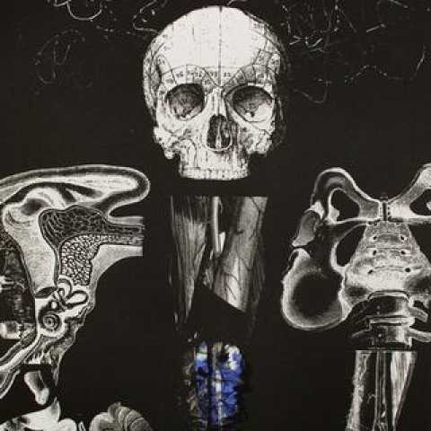Susan Aldworth, Reassembling the Self 1, Lithograph, 2012